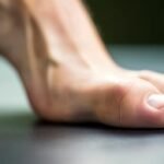 What Are the Six Methods That Are Proven to Be the Most Efficient in Preventing the Development of Bunions?